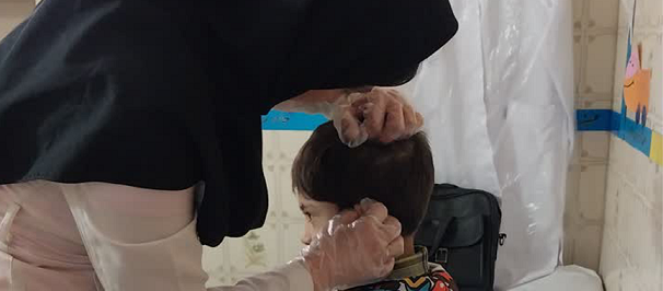 معاینات دوره ای پوست وموی سر(پدیکلوز)